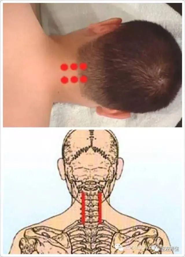 原始点宝宝们,我们感染新冠成小阳人怎么办? 原始点宝宝们,我们感染新冠成小阳人怎么办?