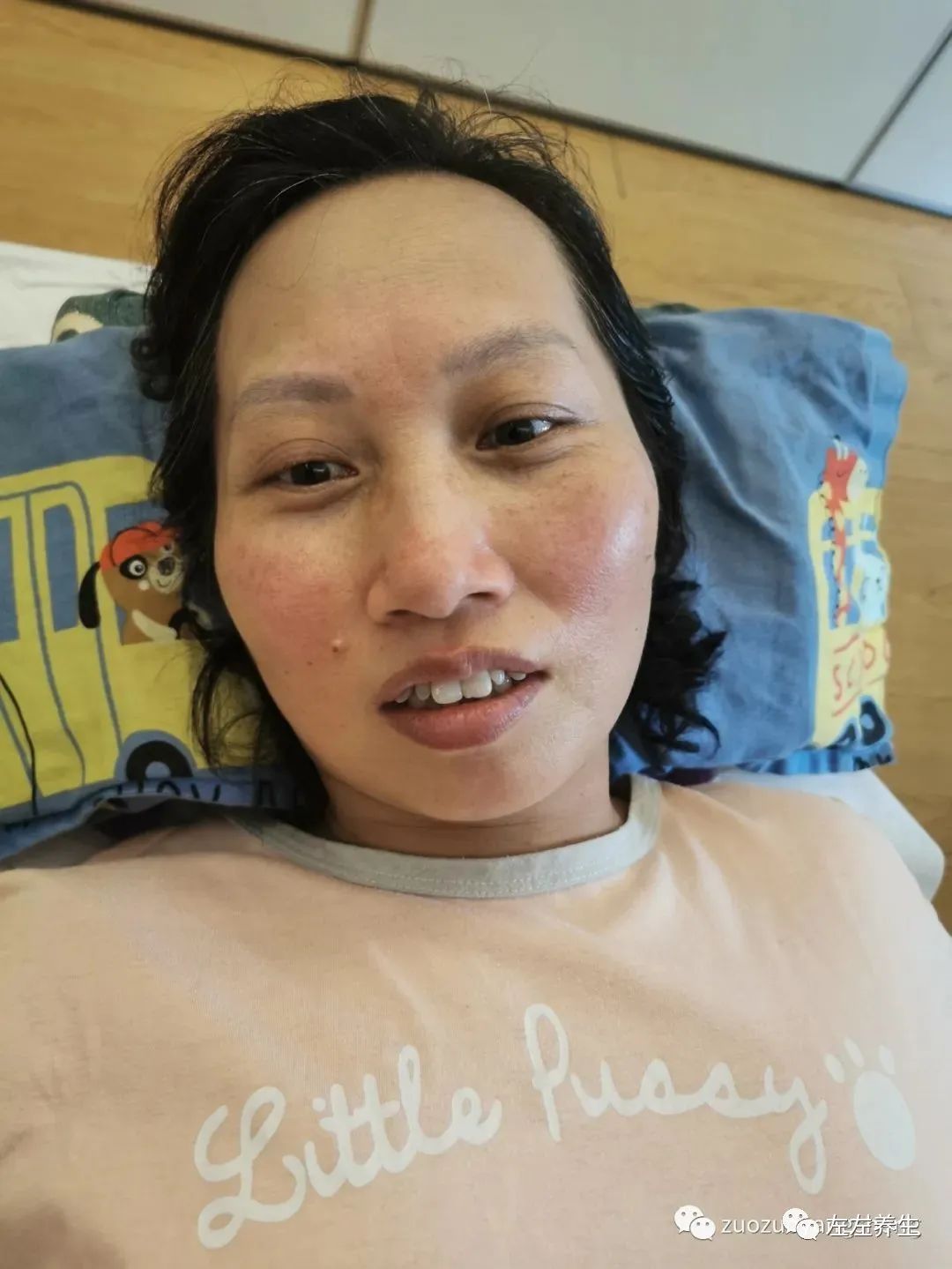 案例分享:脸上玫瑰痤疮调理案例 案例分享:脸上玫瑰痤疮调理案例