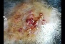 案例分享:小孩毛囊炎反复发作调理案例-七不姜 生姜养生网-明德CSA生态姜园&明安农业