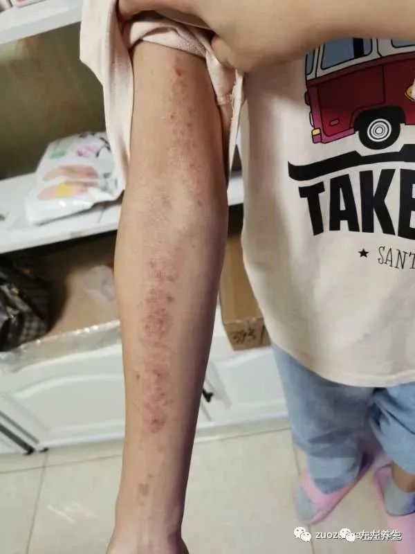 案例分享:学员李女士学习与践行自然疗法的心路历程 案例分享:学员李女士学习与践行自然疗法的心路历程