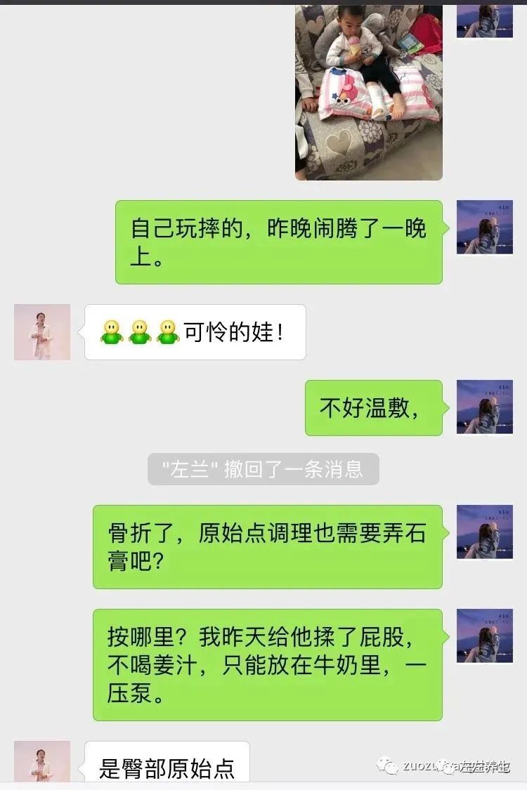 案例分享:三岁孩子右腿骨折调理案例 案例分享:三岁孩子右腿骨折调理案例
