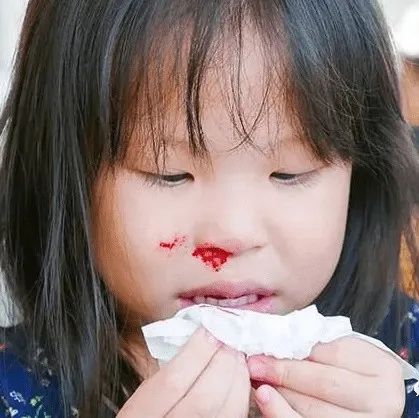 微问答283期：孩子频繁流鼻血原始点如何处理？-七不姜 生姜养生网-明德CSA生态姜园&明安农业