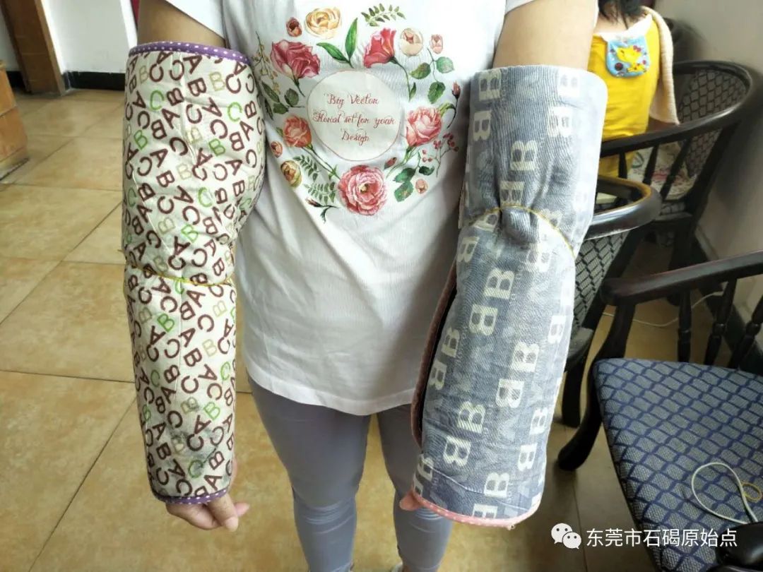 双手肿,胀痛,原始点调理3天康复 双手肿,胀痛,原始点调理3天康复