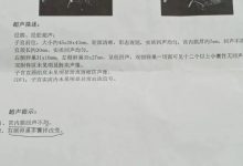 案例分享:多囊卵巢综合征与月经长达三个月的案例-七不姜 生姜养生网-明德CSA生态姜园&明安农业