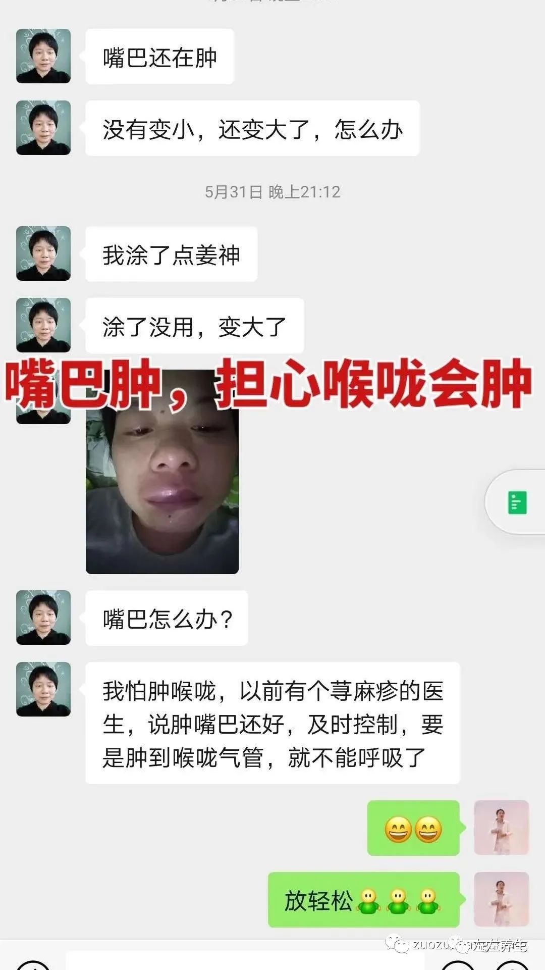 案例分享:调理荨麻疹的好转反应 案例分享:调理荨麻疹的好转反应