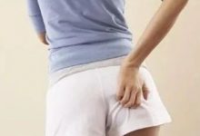 案例分享:痔疮突发大出血调理案例-七不姜 生姜养生网-明德CSA生态姜园&明安农业