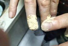 案例分享:手指夹伤后血流不止调理案例-七不姜 生姜养生网-明德CSA生态姜园&明安农业