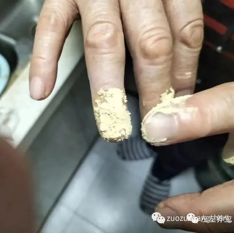 案例分享：手指夹伤后血流不止调理案例-七不姜 生姜养生网-明德CSA生态姜园&明安农业