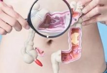 案例分享:肠梗阻住院两天后调理案例-七不姜 生姜养生网-明德CSA生态姜园&明安农业