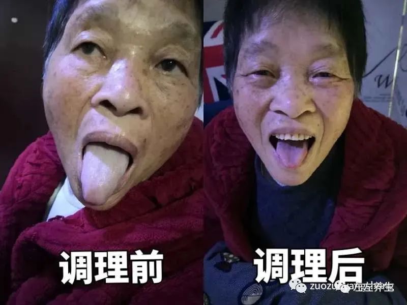 案例分享:70岁老人腹痛(医院初诊可能升结肠癌)飞蛾症、腿抽筋、失眠调理案例 案例分享:70岁老人腹痛(医院初诊可能升结肠癌)飞蛾症、腿抽筋、失眠调理案例