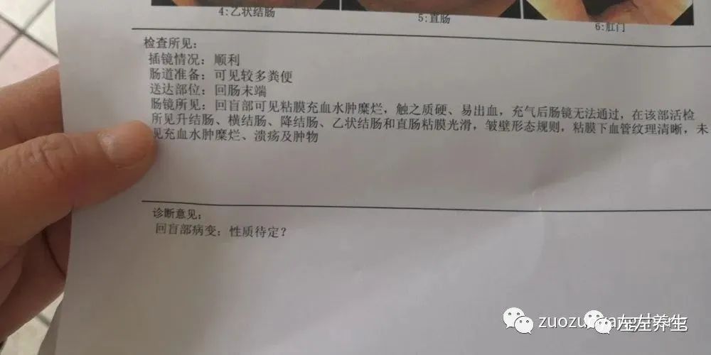 案例分享:70岁老人腹痛(医院初诊可能升结肠癌)飞蛾症、腿抽筋、失眠调理案例 案例分享:70岁老人腹痛(医院初诊可能升结肠癌)飞蛾症、腿抽筋、失眠调理案例