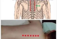 最好的急救方法赶紧学起来吧-七不姜 生姜养生网-明德CSA生态姜园&明安农业
