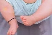 案例分享:小孩尿床的调理案例-七不姜 生姜养生网-明德CSA生态姜园&明安农业