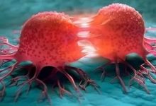 微问答10期:姑姑得了乳腺癌,老公却见死不救?-七不姜 生姜养生网-明德CSA生态姜园&明安农业