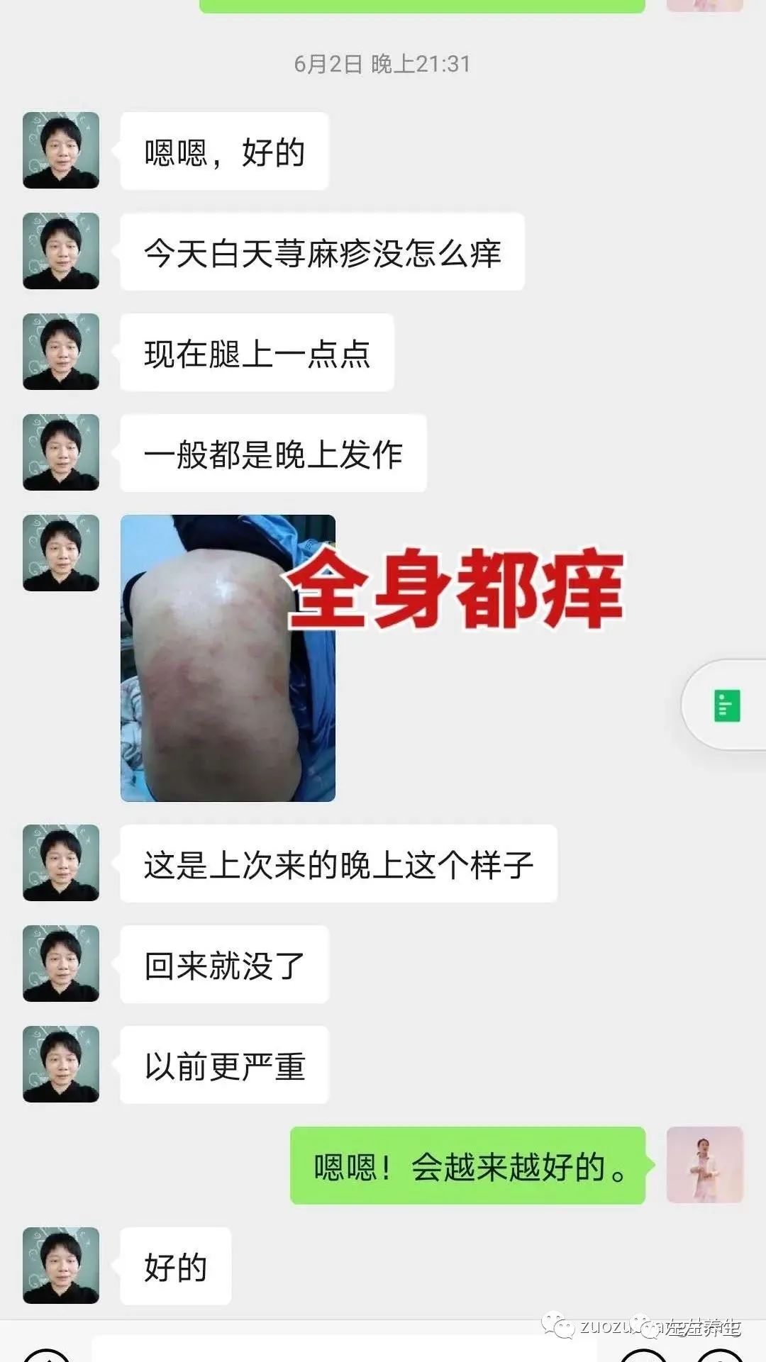 案例分享:调理荨麻疹的好转反应 案例分享:调理荨麻疹的好转反应