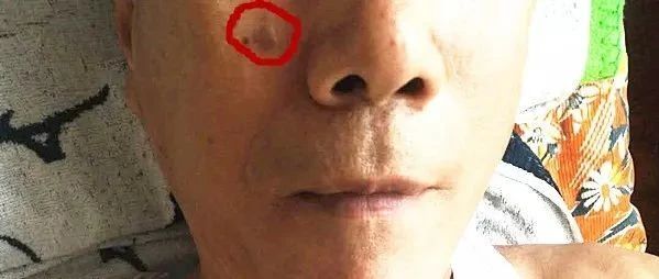 姜汤洗掉了老年斑-七不姜 生姜养生网-明德CSA生态姜园&明安农业
