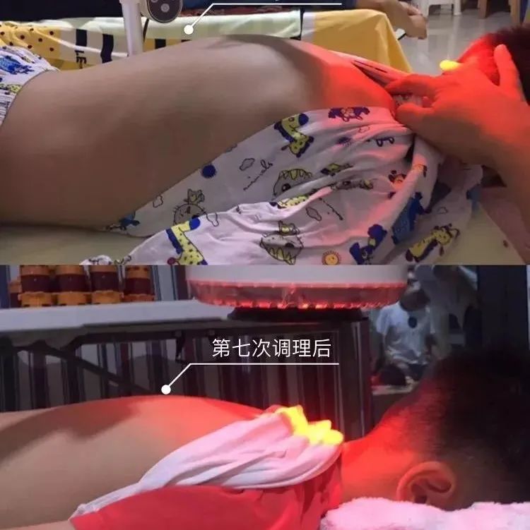 未雨绸缪，如何把握孩子长高季长高？-七不姜 生姜养生网-明德CSA生态姜园&明安农业