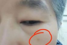 姜膏姜丸的分享(妙用)-七不姜 生姜养生网-明德CSA生态姜园&明安农业