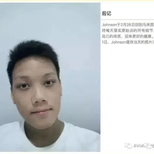 案例分享：马来西亚男孩严重湿疹、十天后大变样-七不姜 生姜养生网-明德CSA生态姜园&明安农业