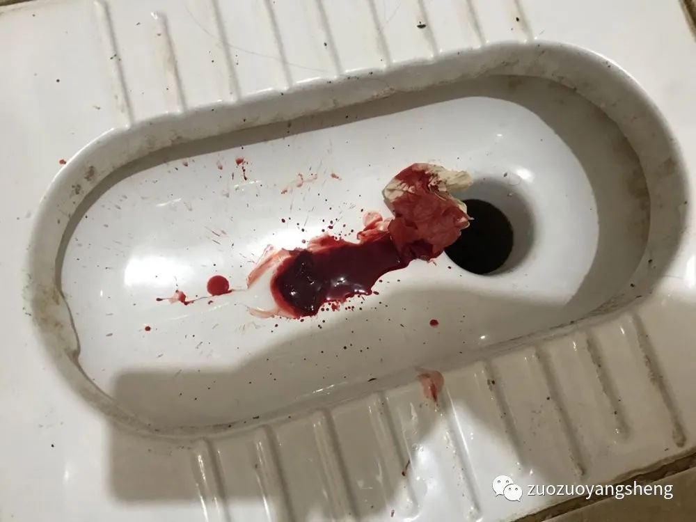 案例分享:原始点调理子宫大出血的案例 案例分享:原始点调理子宫大出血的案例