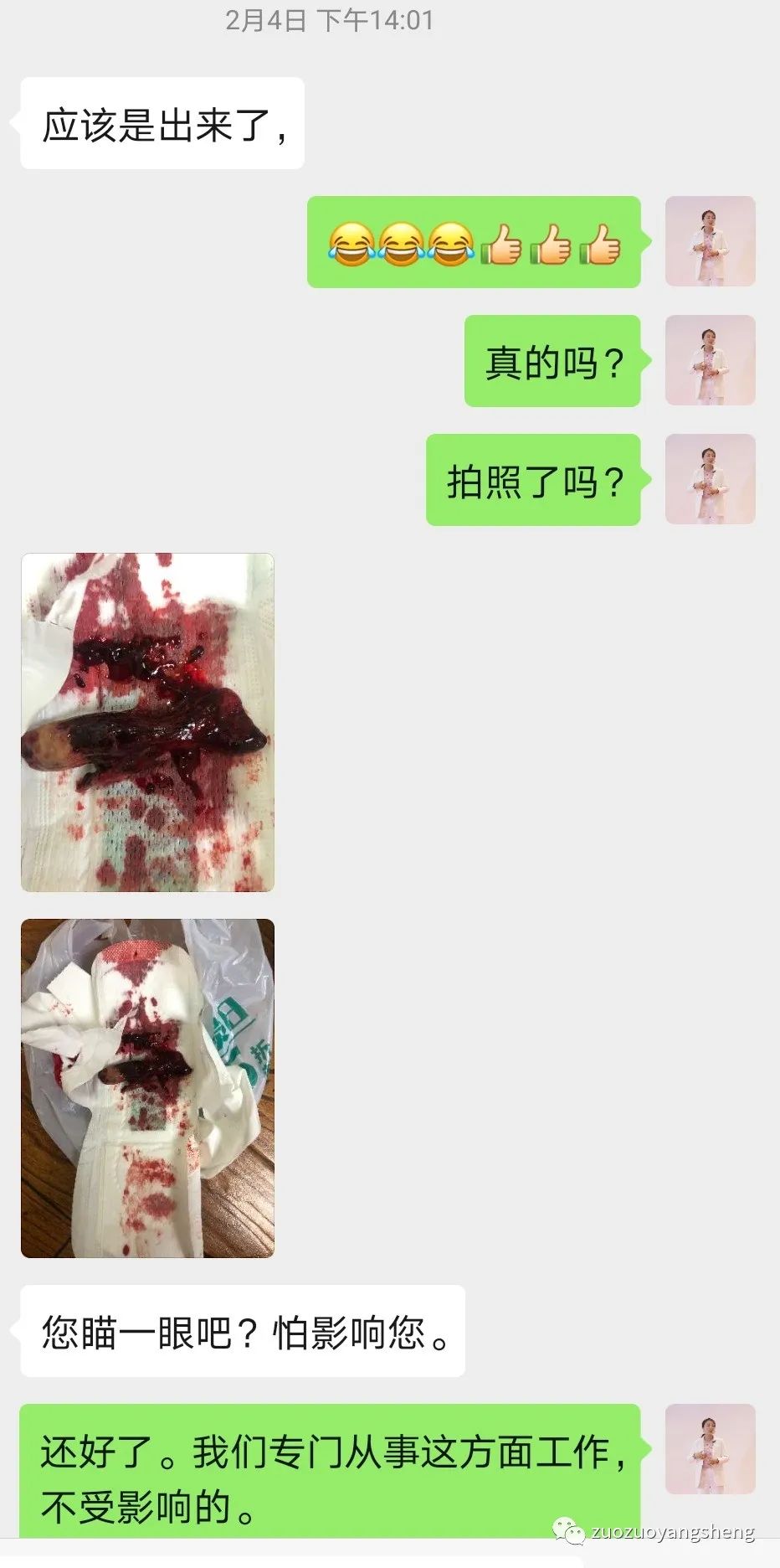 案例分享:原始点调理5天后排出胎死腹中案例 案例分享:原始点调理5天后排出胎死腹中案例