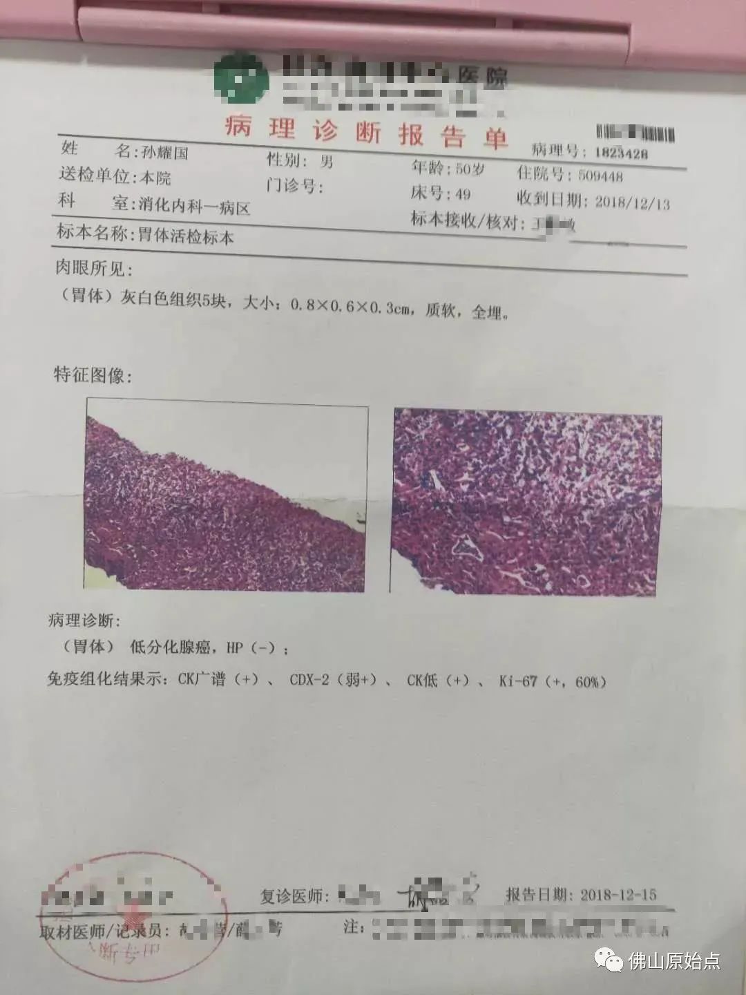 原始点调理胃癌案例 原始点调理胃癌案例