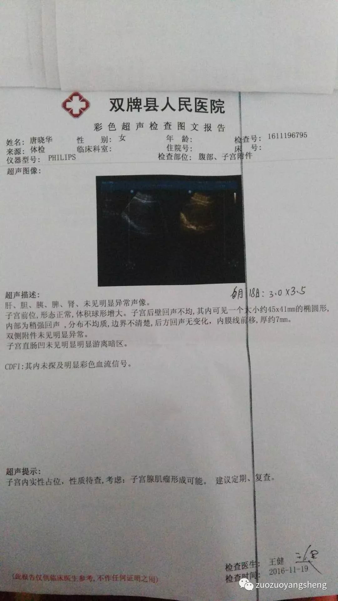 坚持原始点调理,43天排出死胎的案例 坚持原始点调理,43天排出死胎的案例