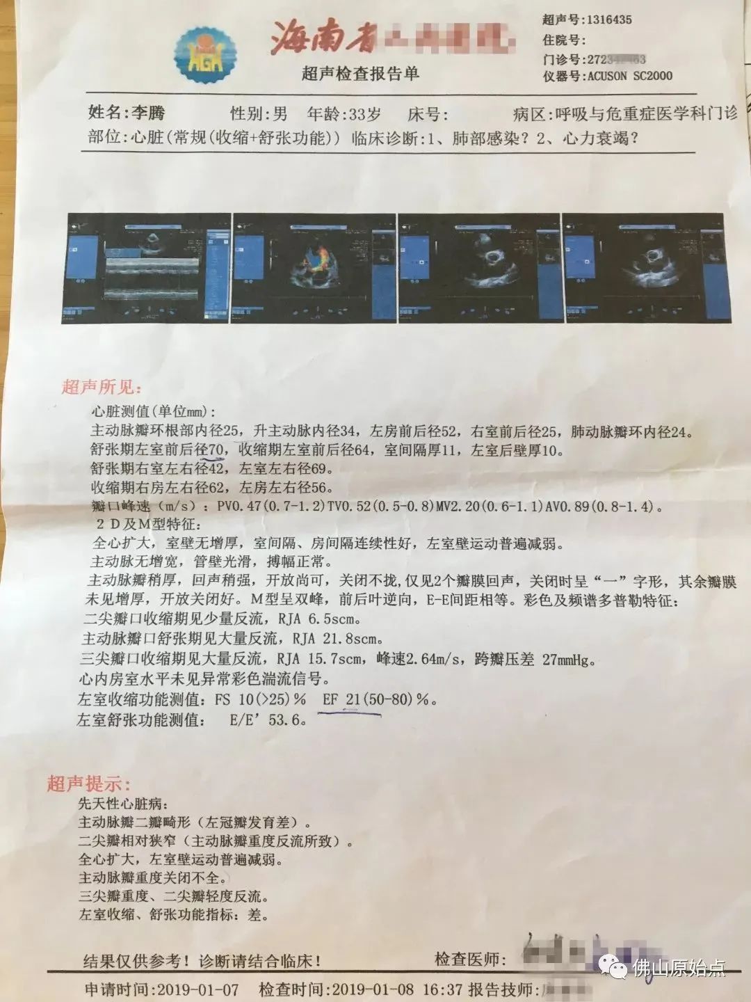 佛山原始点中心学员花开海南——原始点调理咳血心力衰竭等多种症状案例:打破失败的怪圈,从三次失败走向成功 佛山原始点中心学员花开海南——原始点调理咳血心力衰竭等多种症状案例:打破失败的怪圈,从三次失败走向成功