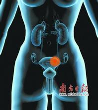 子宫肌瘤、乳腺癌原来是这么回事！看完我目瞪口呆！