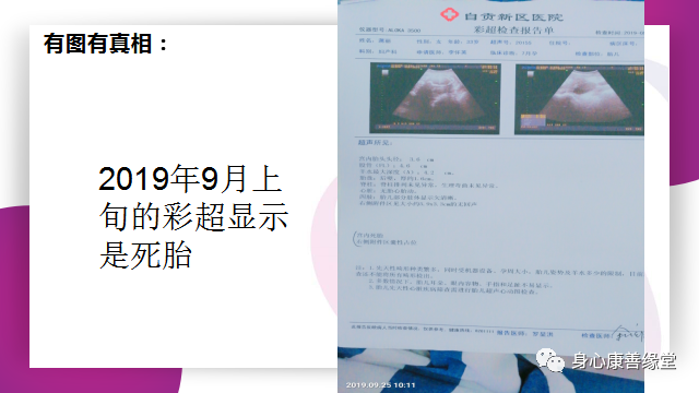 怀胎七月,胎死腹中2月患者康复案例 怀胎七月,胎死腹中2月患者康复案例
