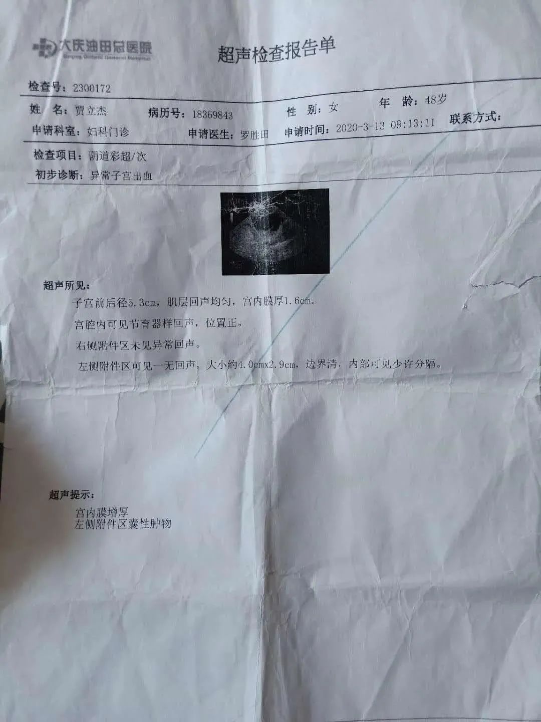 原始点调理妇科宫颈案例 原始点调理妇科宫颈案例