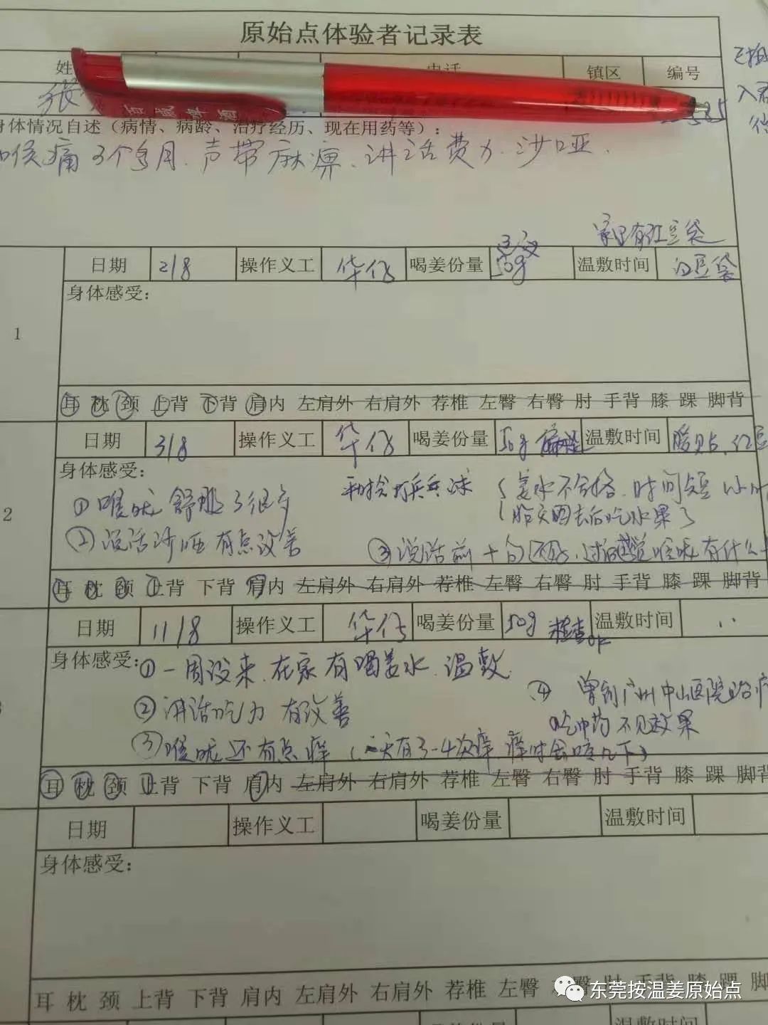 声带麻痹,说话费力、沙哑,咽痛 声带麻痹,说话费力、沙哑,咽痛