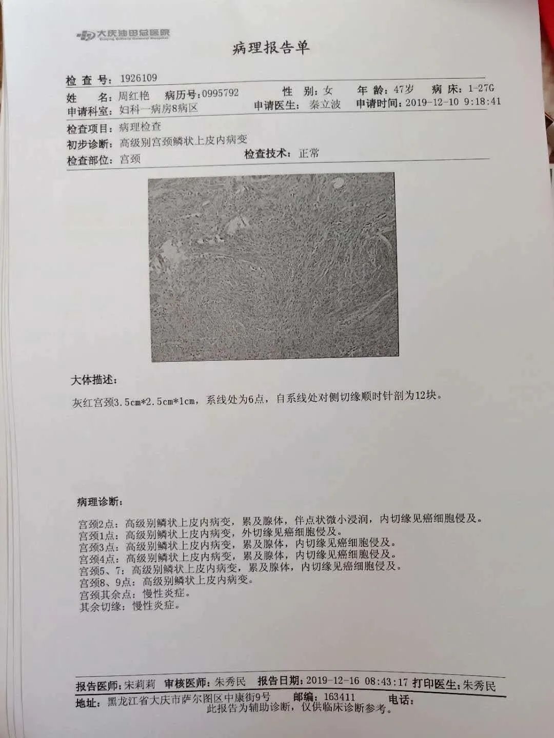 原始点调理妇科宫颈案例 原始点调理妇科宫颈案例