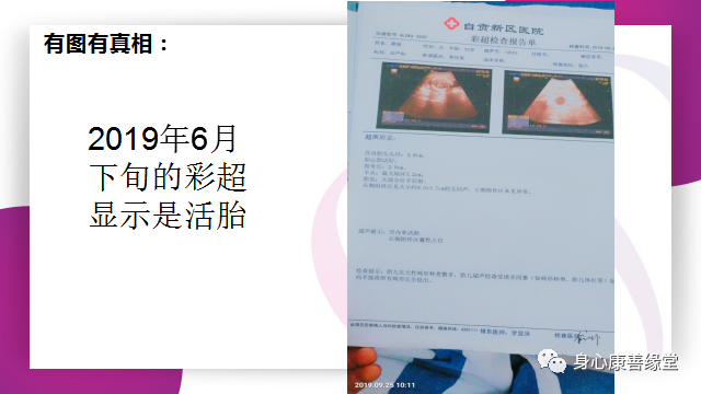 怀胎七月,胎死腹中2月患者康复案例 怀胎七月,胎死腹中2月患者康复案例