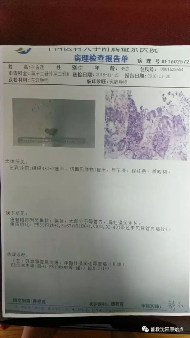 原位乳腺癌保乳再生追踪 原位乳腺癌保乳再生追踪