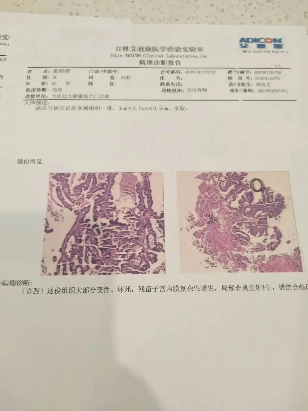 原始点调理妇科宫颈案例 原始点调理妇科宫颈案例