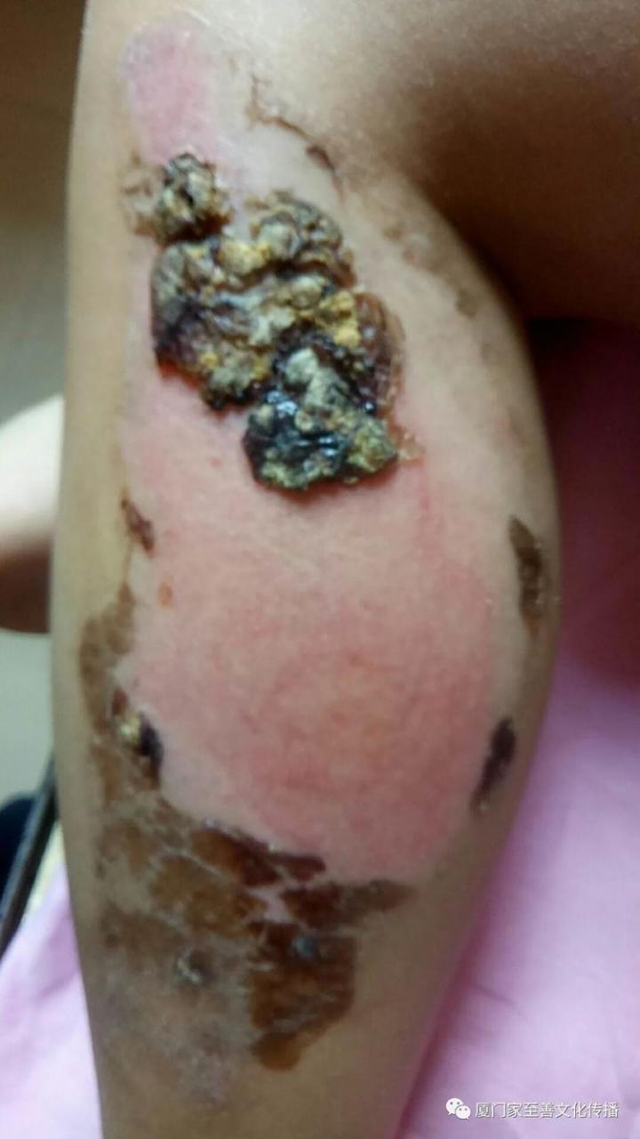 自动草稿 自动草稿