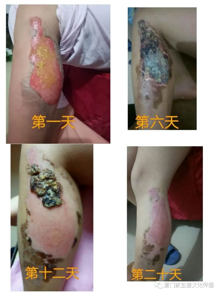 自动草稿 自动草稿