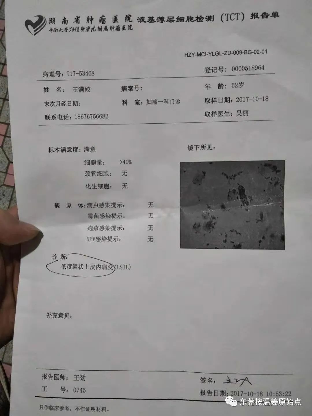 宫颈癌放化疗后遗症 宫颈癌放化疗后遗症