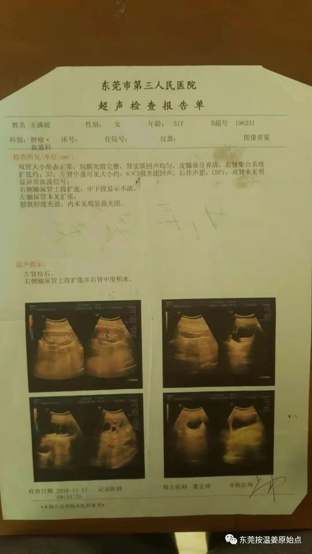 宫颈癌放化疗后遗症 宫颈癌放化疗后遗症