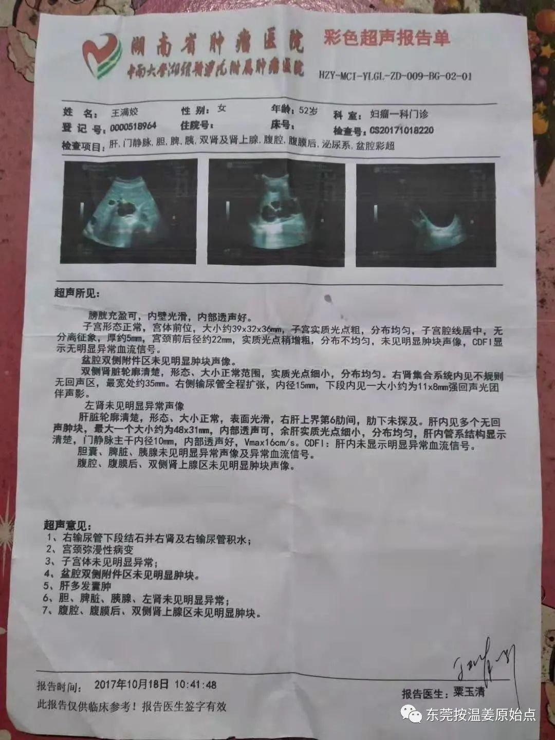 宫颈癌放化疗后遗症 宫颈癌放化疗后遗症