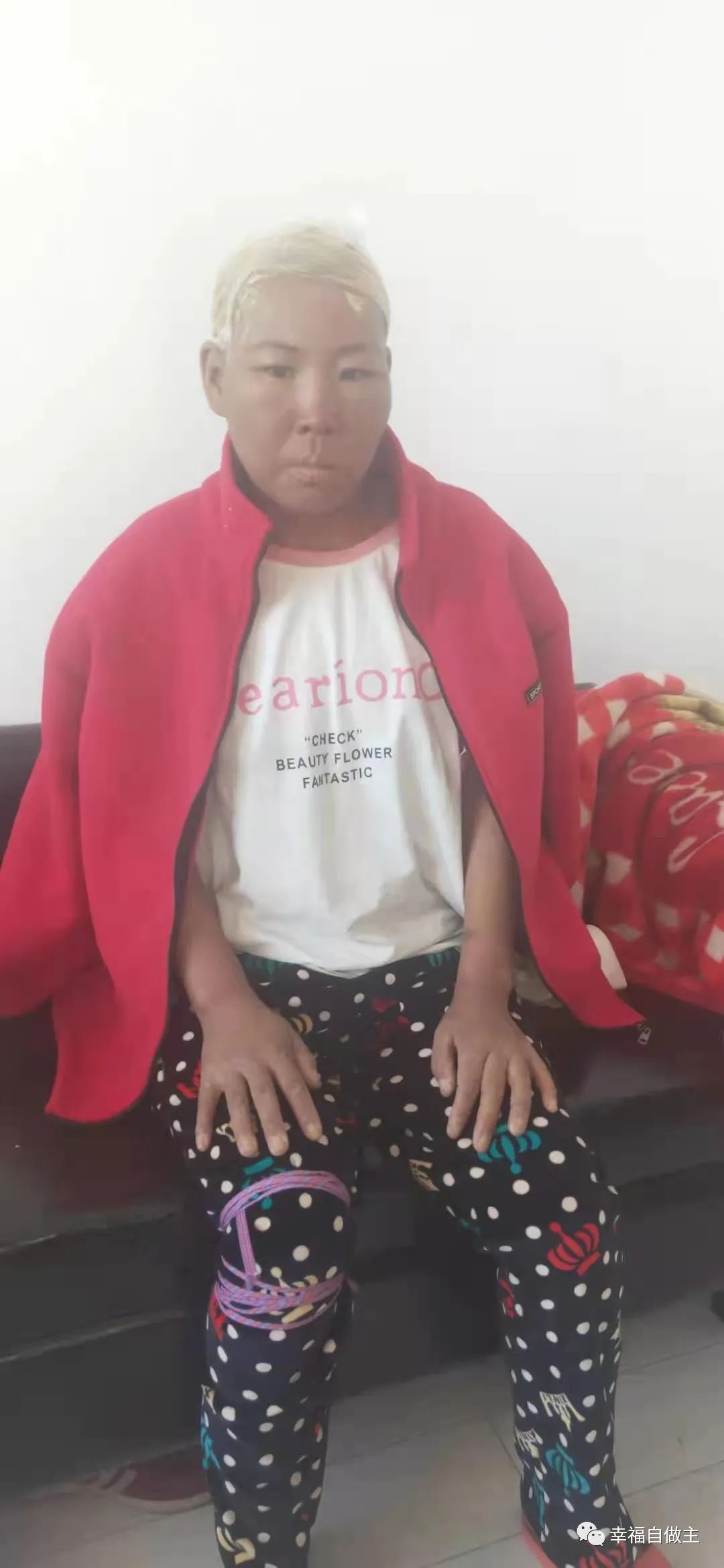 血癌恢复案例后续 血癌恢复案例后续