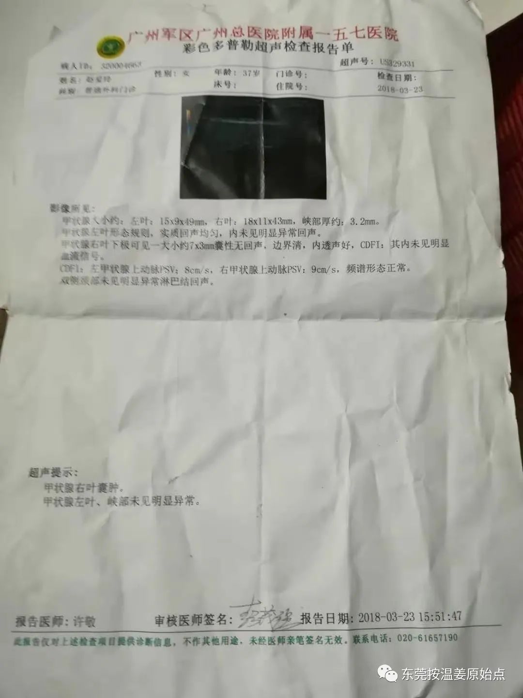 严重妇科病:阴道炎,宫颈炎,盘腔积液 严重妇科病:阴道炎,宫颈炎,盘腔积液