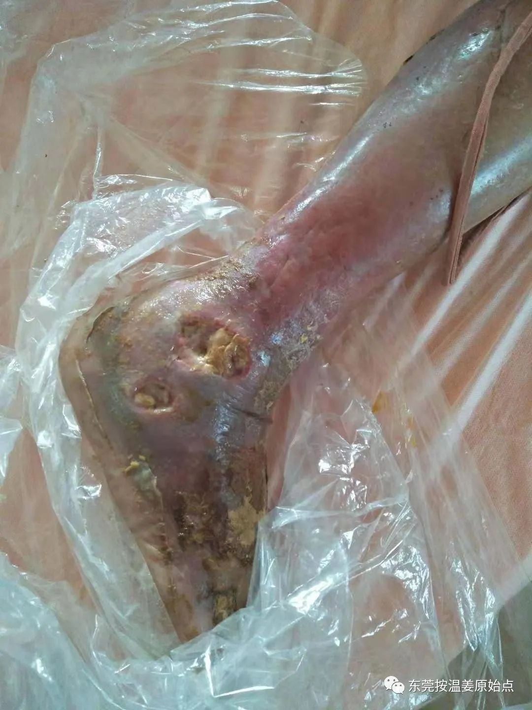 原始点让87岁中风的老爷爷免除截肢,重新行走 原始点让87岁中风的老爷爷免除截肢,重新行走