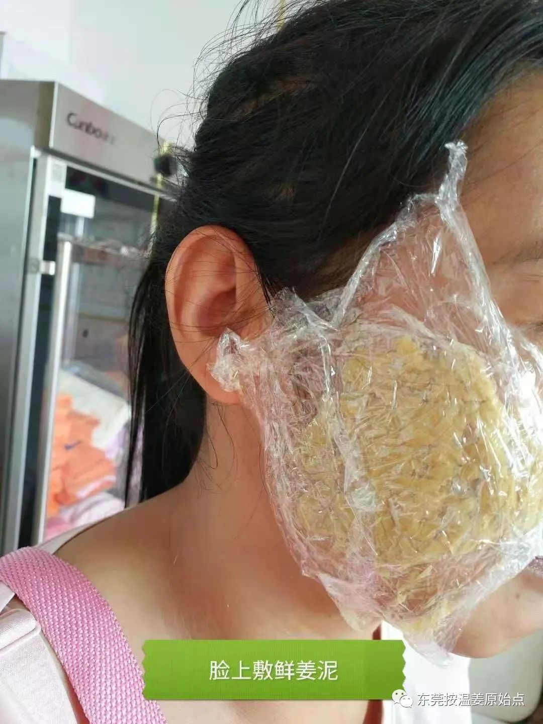 原始点处理肋骨断7根,胸腔积液等 原始点处理肋骨断7根,胸腔积液等