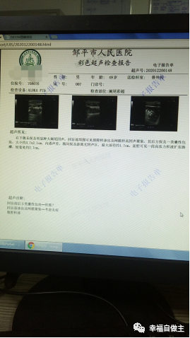 阑尾炎穿孔，腹膜炎，盆腔积液案例