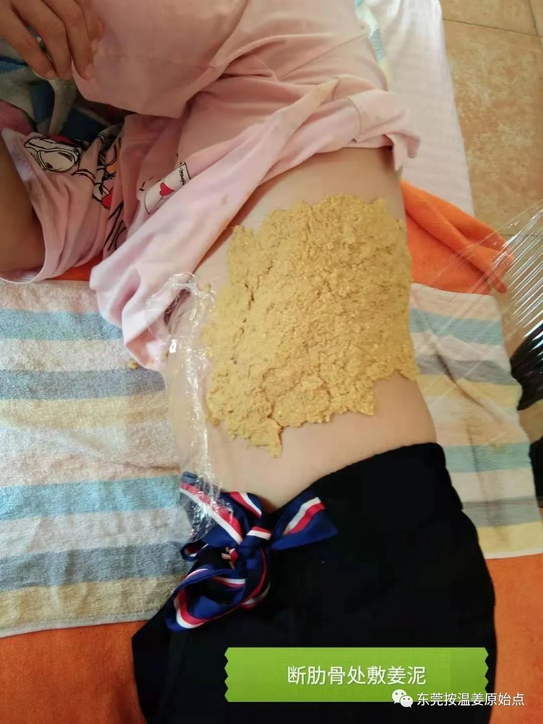 原始点处理肋骨断7根,胸腔积液等 原始点处理肋骨断7根,胸腔积液等