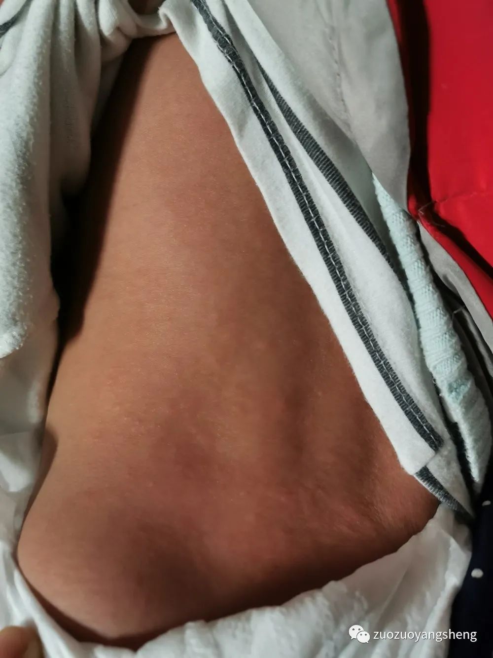 案例分享：原始点调理反复高烧和婴幼儿急疹案例