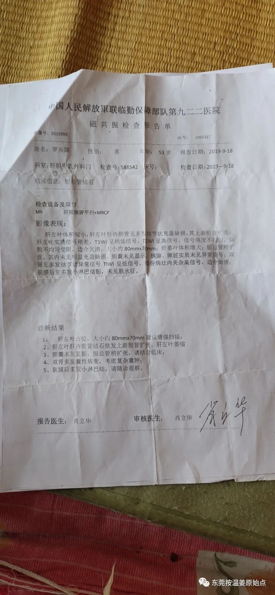 肝内胆结石,肝肿瘤80mm*70mm 肝内胆结石,肝肿瘤80mm*70mm