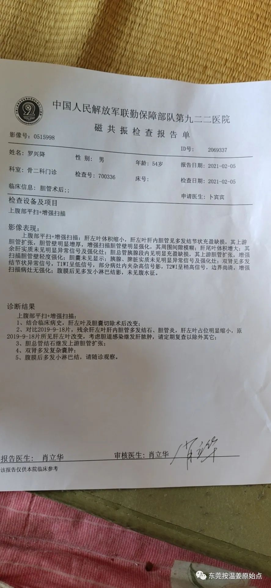 肝内胆结石,肝肿瘤80mm*70mm 肝内胆结石,肝肿瘤80mm*70mm